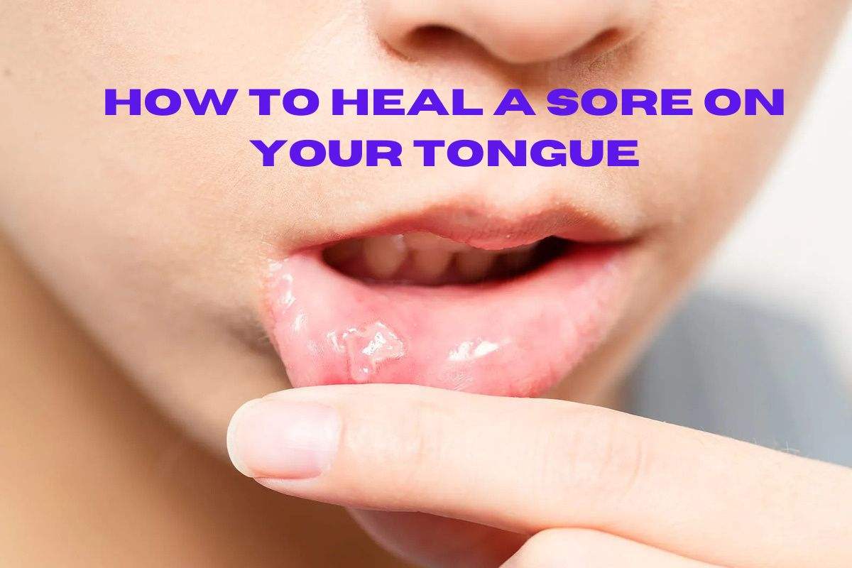 How to Heal a Sore on Your Tongue